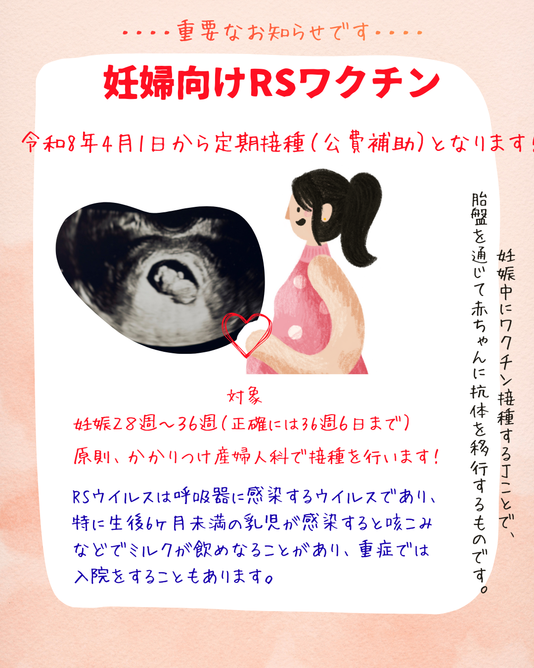 妊婦向けRSワクチンが4月1日から公費補助となります。